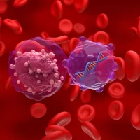 Chronic lymphocytic leukemia (CLL) and diet and cancer